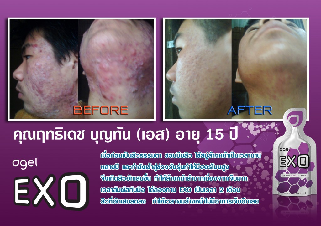 testimonial_exo_s